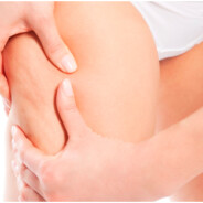 Claves para Combatir la Celulitis