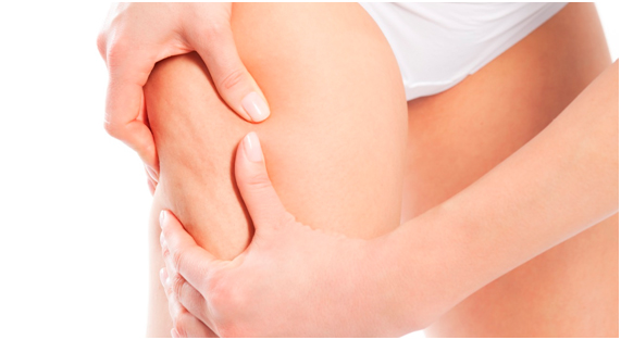 Claves para Combatir la Celulitis